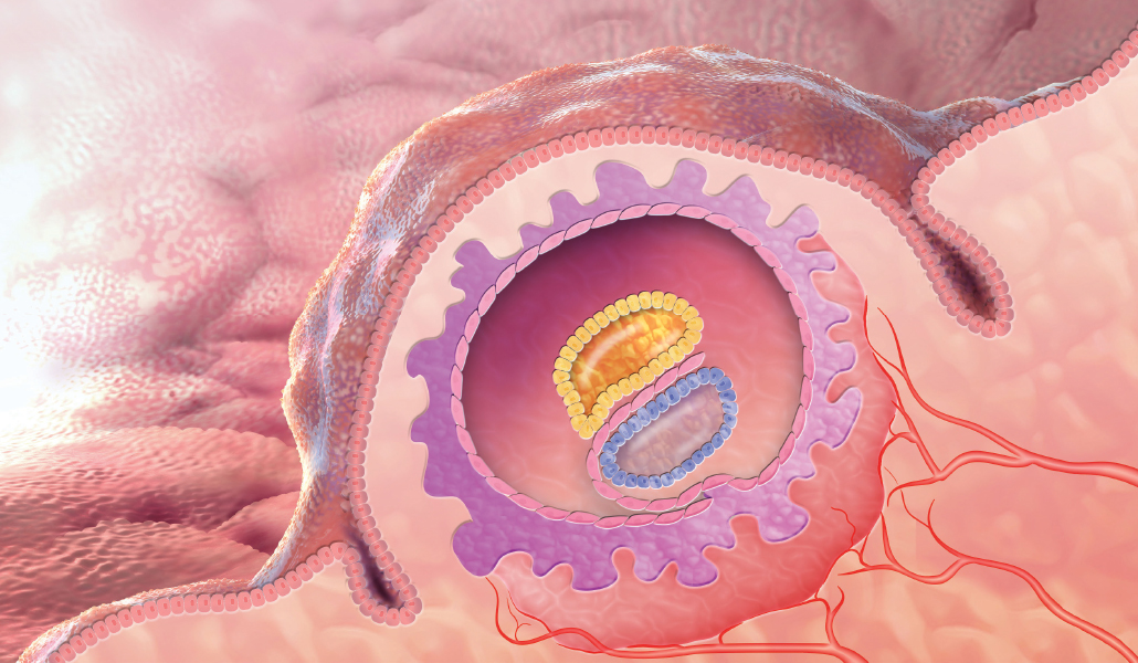 illustration of an egg implanted in the uterine wall