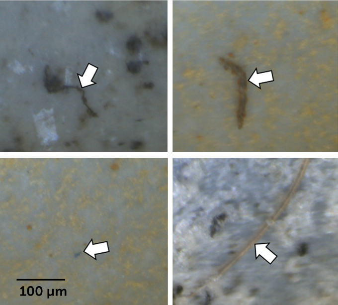 Four microscope images showing microplastic particles found in human lung tissue.