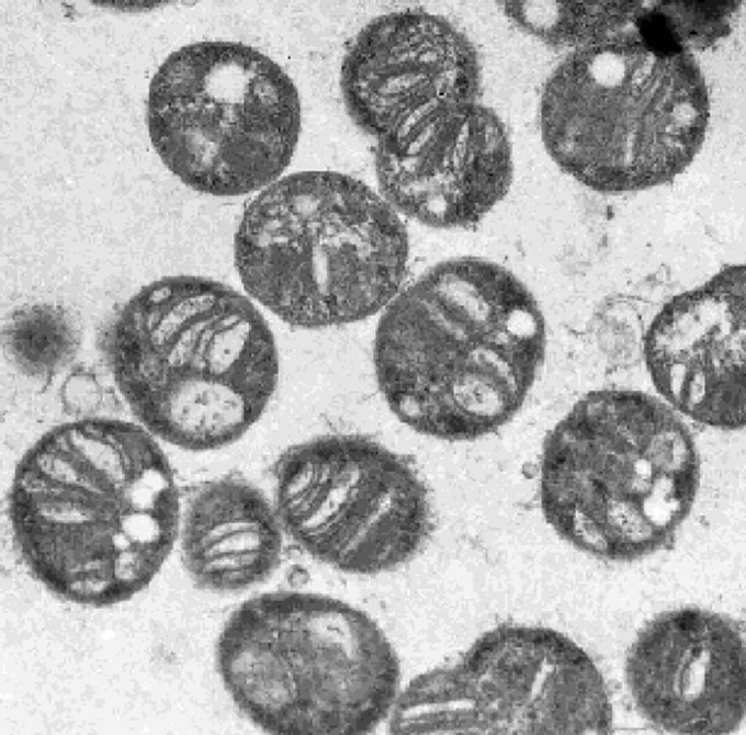 A microscope image shows Methylococcus capsulatus bacteria cells.